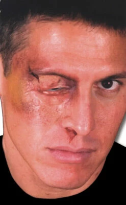 Geschwollenes Auge Wunde